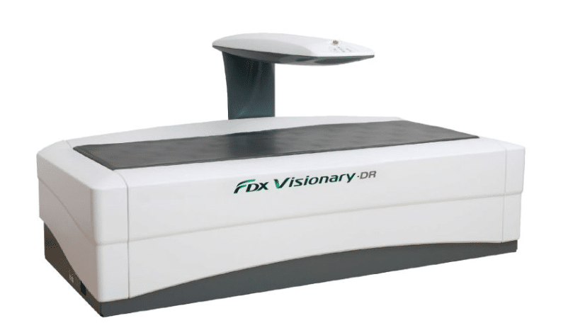 Mit mutat meg a csontsűrűség vizsgálat eredménye, és hogyan értelmezhető biztonságosan?